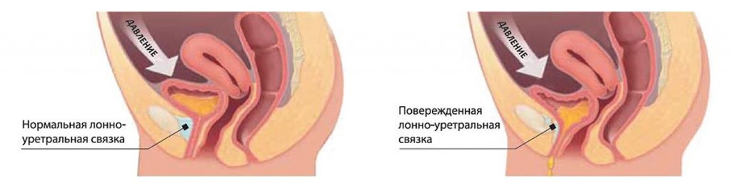 Откуда выходит моча у девушек фото